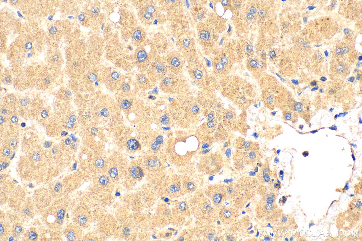Immunohistochemistry (IHC) staining of human liver tissue using MAP4K1 Polyclonal antibody (23950-1-AP)
