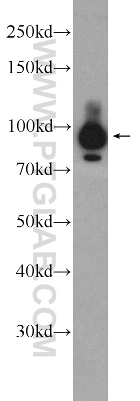 Western Blot (WB) analysis of Jurkat cells using MAP4K1 Polyclonal antibody (23950-1-AP)