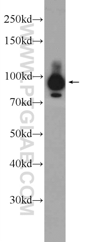 WB analysis of Jurkat using 23950-1-AP