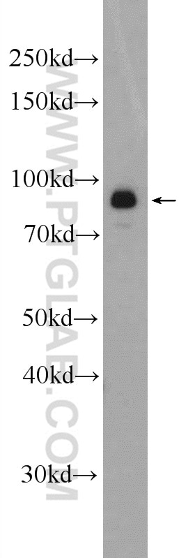 Western Blot (WB) analysis of Jurkat cells using MAP4K1 Polyclonal antibody (23950-1-AP)