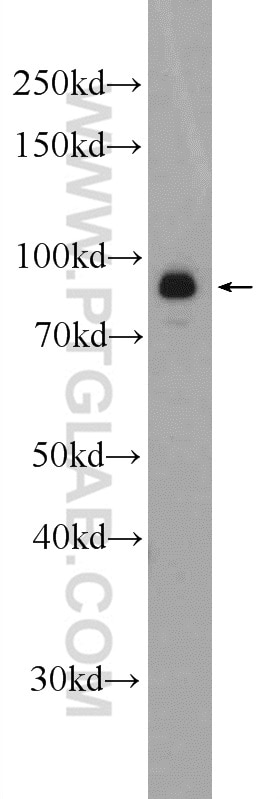 WB analysis of Jurkat using 23950-1-AP