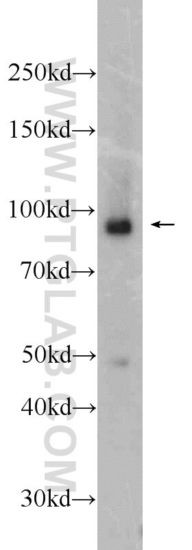 Western Blot (WB) analysis of Raji cells using MAP4K1 Polyclonal antibody (23950-1-AP)