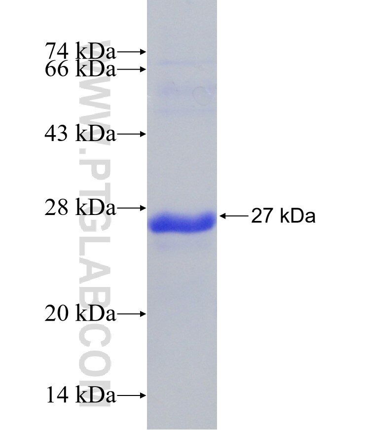 MAP4K1 fusion protein Ag20221 SDS-PAGE