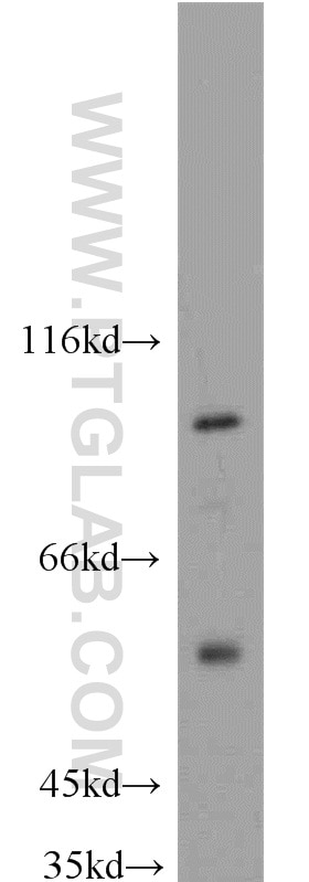 Western Blot (WB) analysis of mouse brain tissue using MAP4K2 Polyclonal antibody (55244-1-AP)
