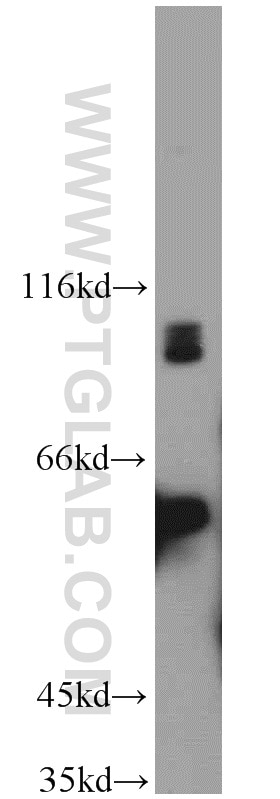 Western Blot (WB) analysis of human brain tissue using MAP4K2 Polyclonal antibody (55244-1-AP)