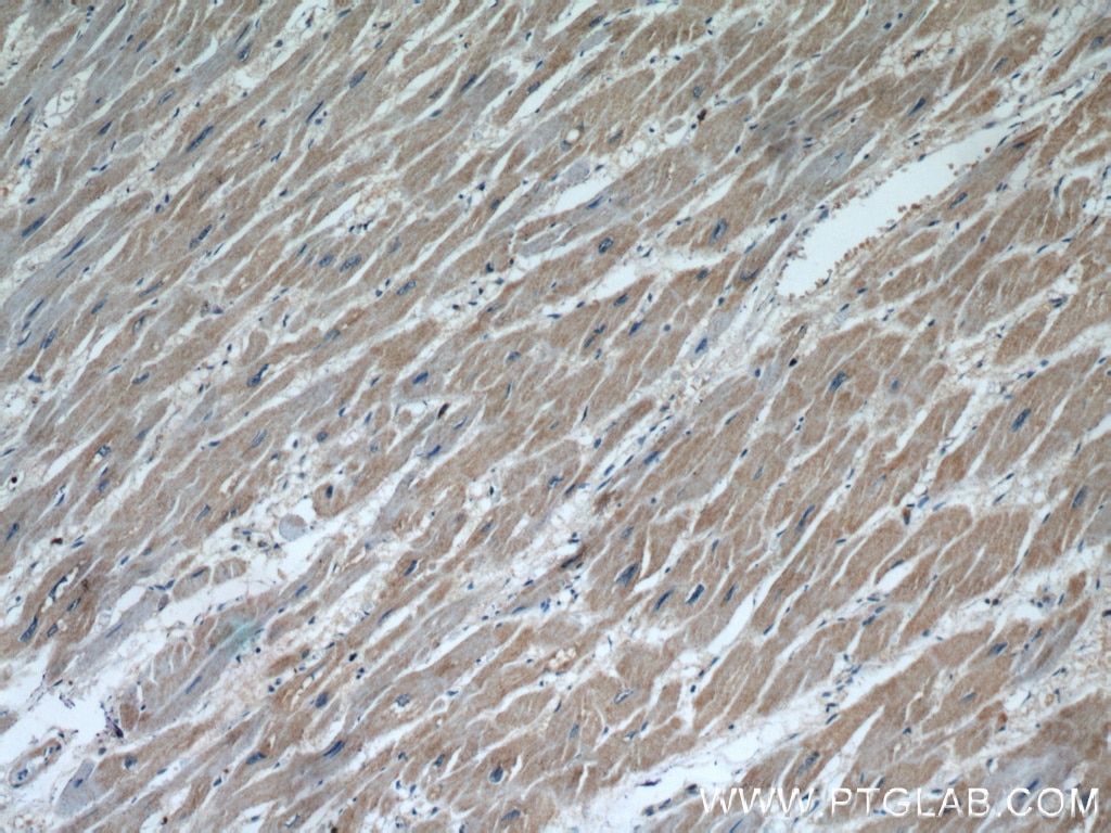 Immunohistochemistry (IHC) staining of human heart tissue using MAP4K3 Polyclonal antibody (14702-1-AP)