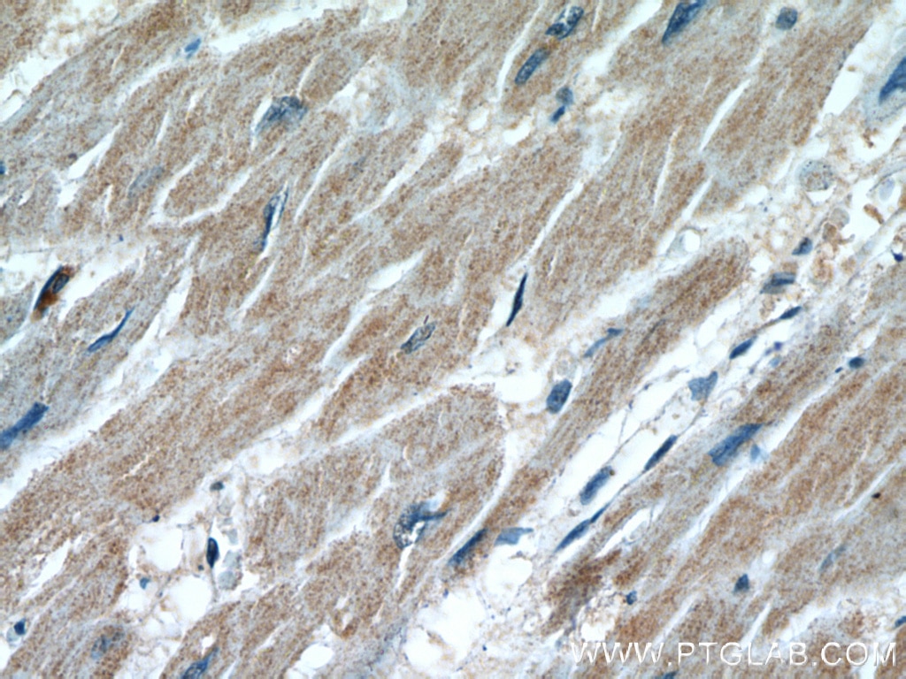 Immunohistochemistry (IHC) staining of human heart tissue using MAP4K3 Polyclonal antibody (14702-1-AP)