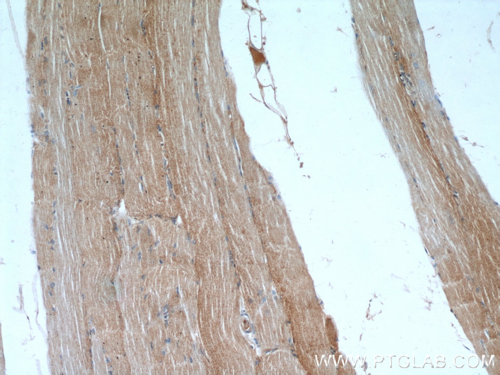 Immunohistochemistry (IHC) staining of human skeletal muscle tissue using MAP4K3 Polyclonal antibody (14702-1-AP)