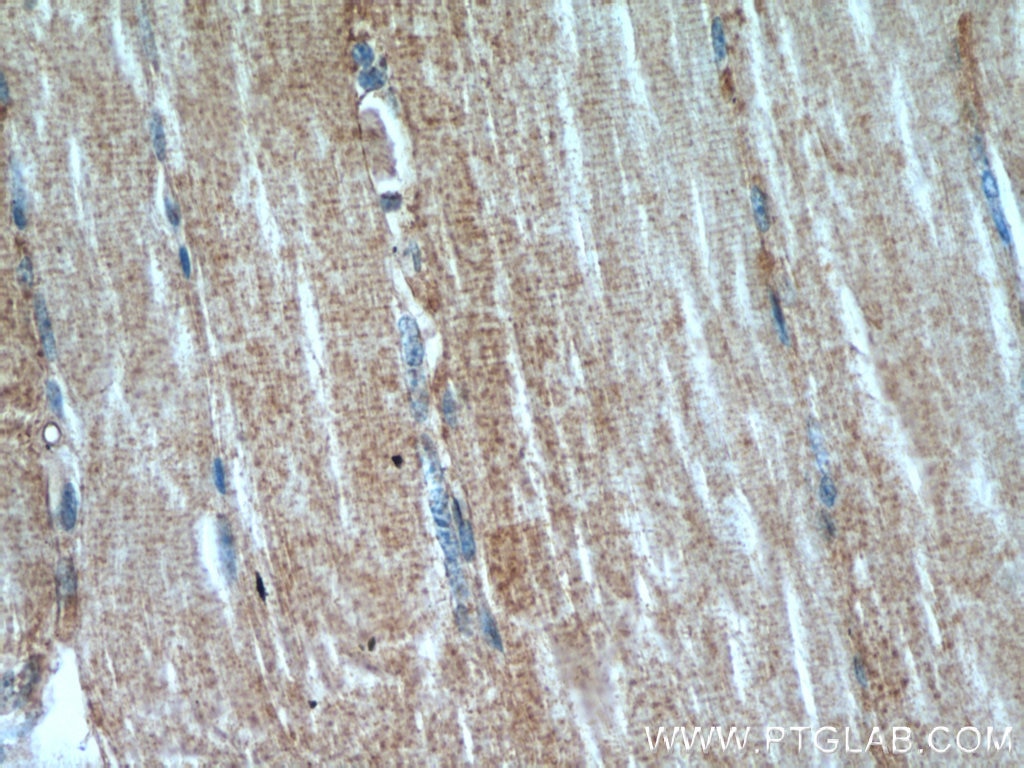 Immunohistochemistry (IHC) staining of human skeletal muscle tissue using MAP4K3 Polyclonal antibody (14702-1-AP)