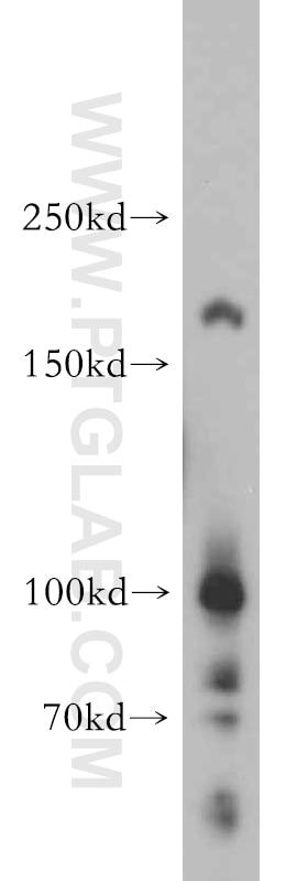 Western Blot (WB) analysis of human brain tissue using MAP4K3 Polyclonal antibody (14702-1-AP)