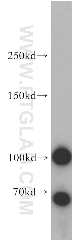 WB analysis of HeLa using 14702-1-AP