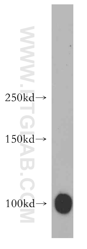 Western Blot (WB) analysis of human skeletal muscle tissue using MAP4K3 Polyclonal antibody (14702-1-AP)