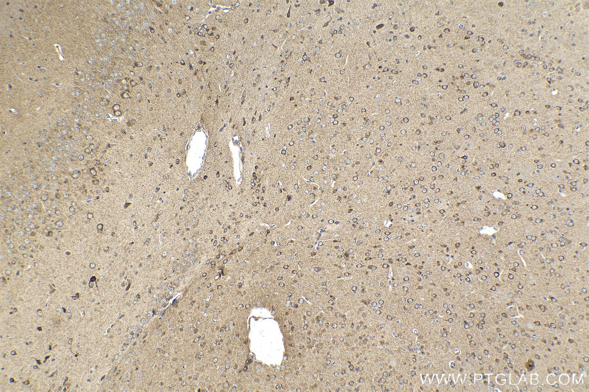 Immunohistochemistry (IHC) staining of mouse brain tissue using MAP4K4 Polyclonal antibody (55247-1-AP)