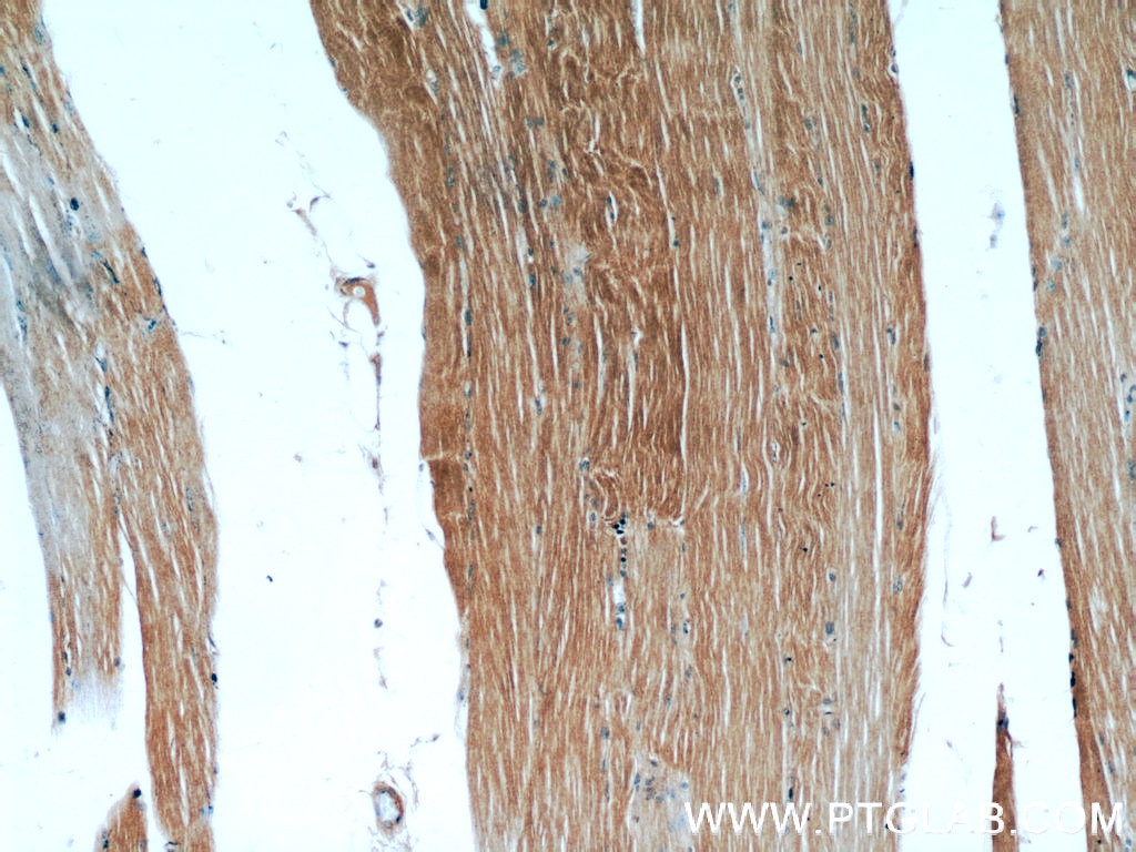 Immunohistochemistry (IHC) staining of human skeletal muscle tissue using MAP4K4 Polyclonal antibody (55247-1-AP)