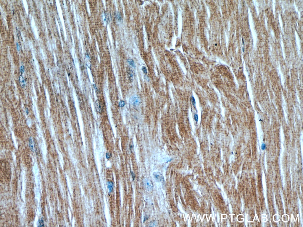 Immunohistochemistry (IHC) staining of human skeletal muscle tissue using MAP4K4 Polyclonal antibody (55247-1-AP)