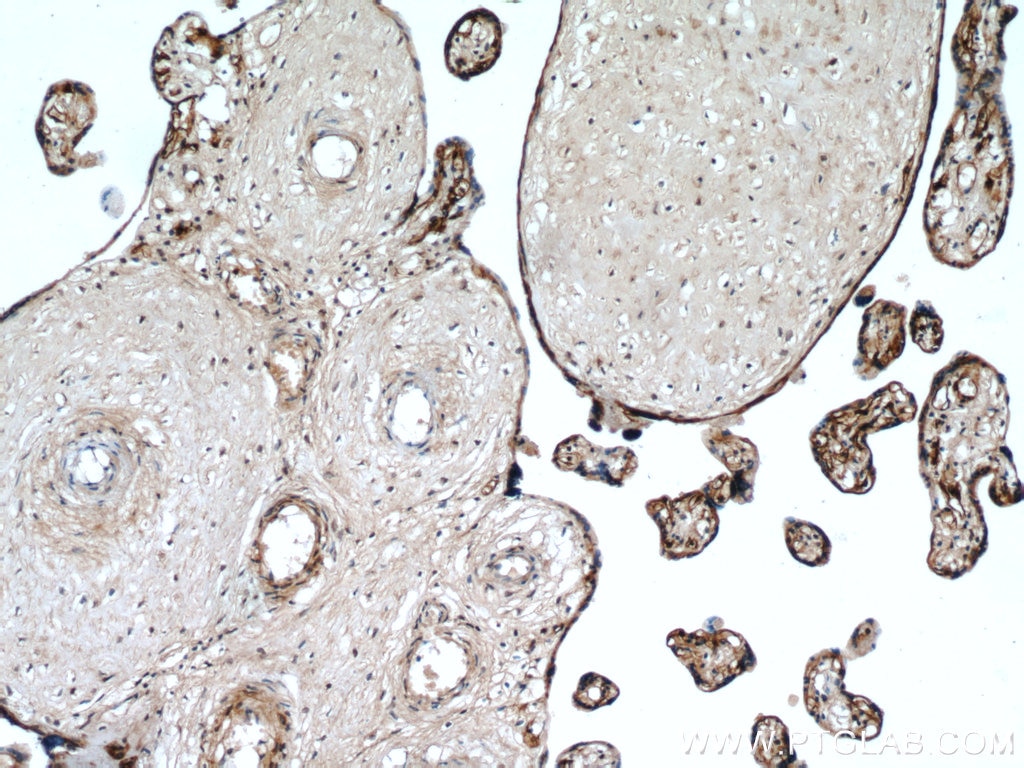 Immunohistochemistry (IHC) staining of human placenta tissue using MAP4K4 Polyclonal antibody (55247-1-AP)