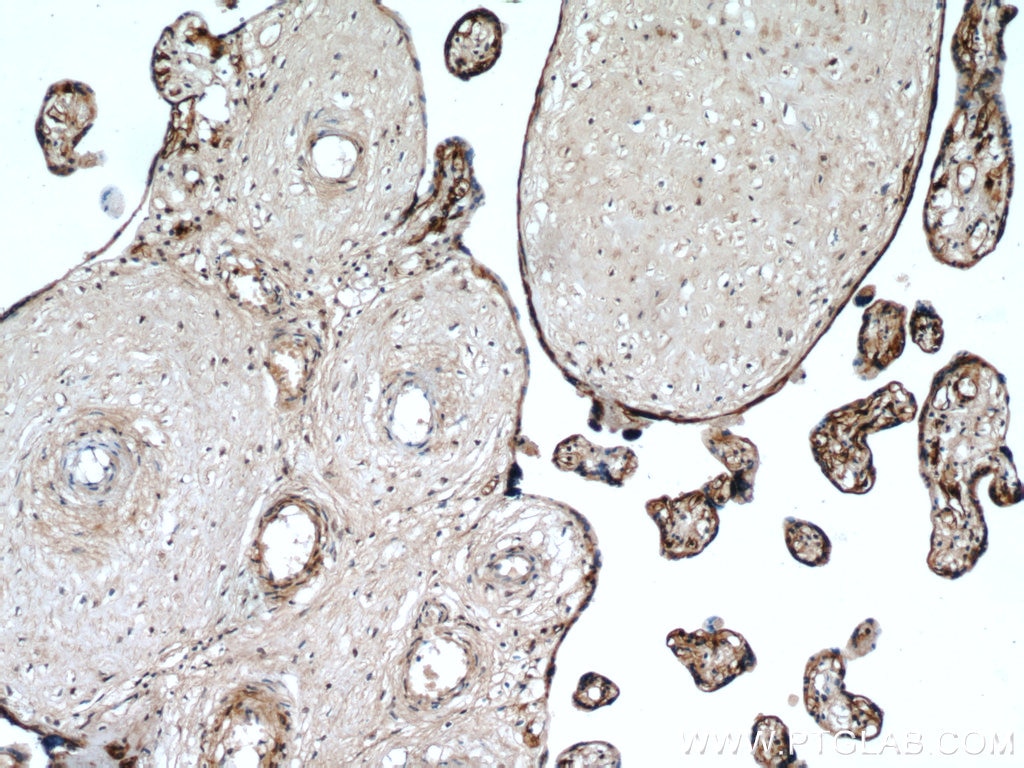 IHC staining of human placenta using 55247-1-AP