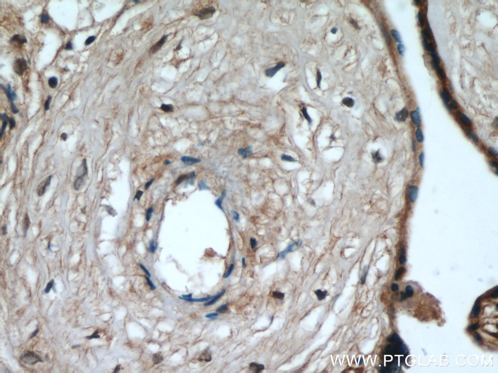 Immunohistochemistry (IHC) staining of human placenta tissue using MAP4K4 Polyclonal antibody (55247-1-AP)