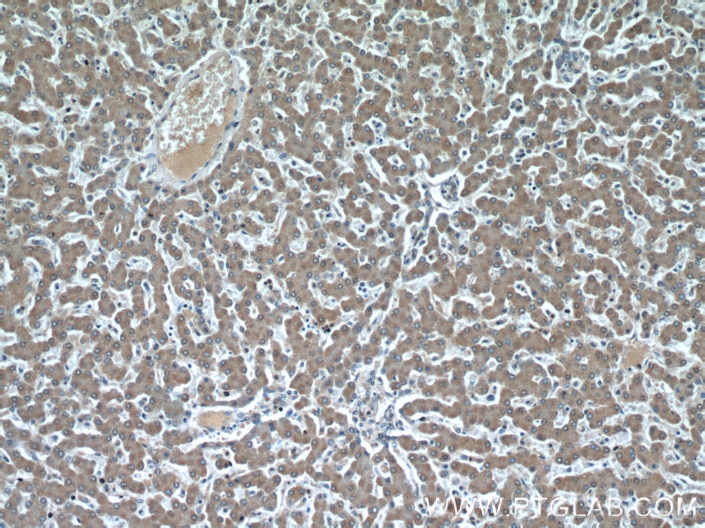 Immunohistochemistry (IHC) staining of human liver tissue using MAP4K4 Polyclonal antibody (55247-1-AP)