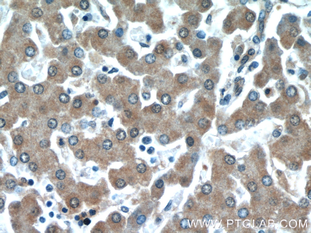 Immunohistochemistry (IHC) staining of human liver tissue using MAP4K4 Polyclonal antibody (55247-1-AP)