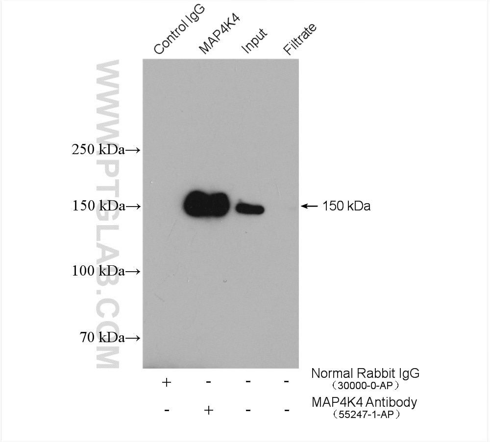 Immunoprecipitation (IP) experiment of Jurkat cells using MAP4K4 Polyclonal antibody (55247-1-AP)