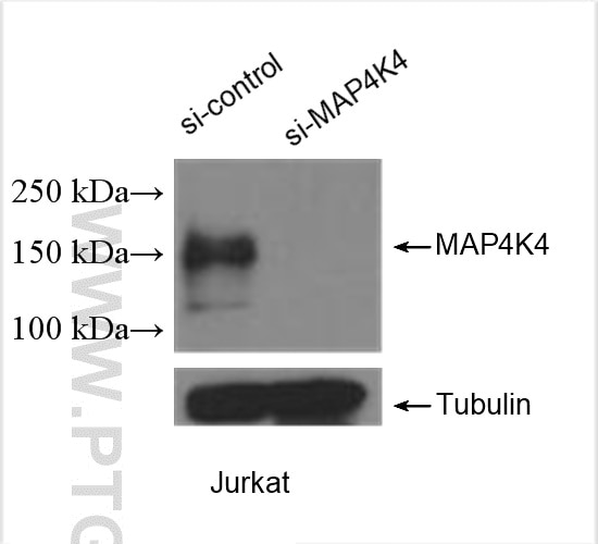 Western Blot (WB) analysis of Jurkat cells using MAP4K4 Polyclonal antibody (55247-1-AP)