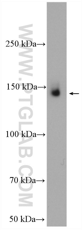 Western Blot (WB) analysis of Jurkat cells using MAP4K4 Polyclonal antibody (55247-1-AP)