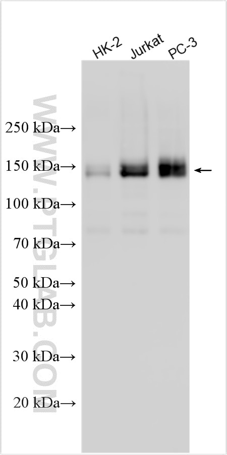 Western Blot (WB) analysis of various lysates using MAP4K4 Polyclonal antibody (55247-1-AP)