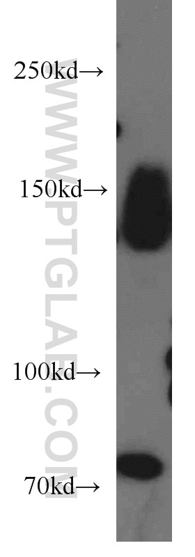 Western Blot (WB) analysis of PC-3 cells using MAP4K4 Polyclonal antibody (55247-1-AP)