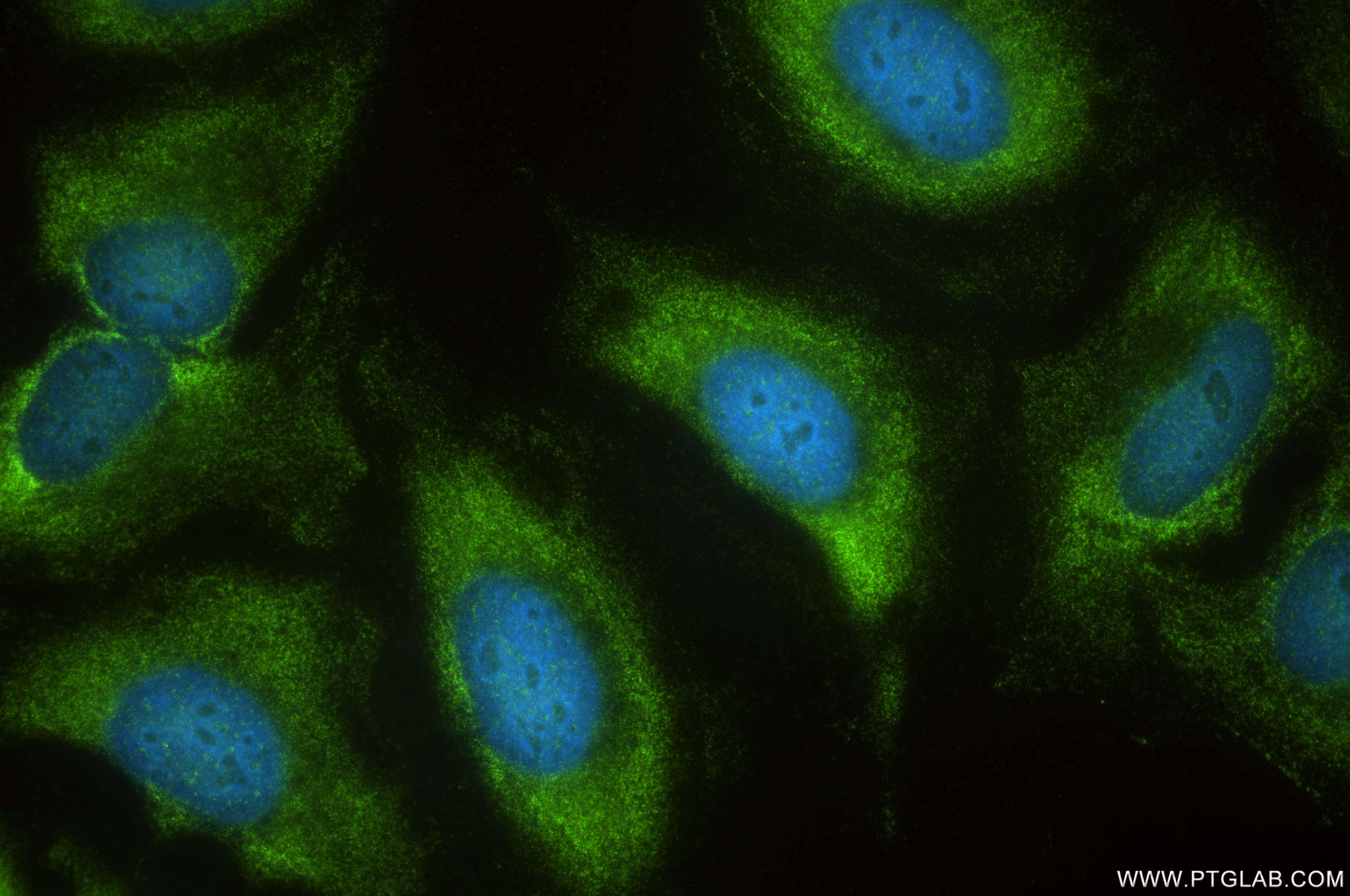 Immunofluorescent analysis of (-20°C Ethanol) fixed HeLa cells using MAP4K4 antibody (85387-1-RR, Clone: 242721G1 ) at dilution of 1:400 and CoraLite®488-Conjugated Goat Anti-Rabbit IgG(H+L) (SA00013-2). Immunofluorescence (IF) / fluorescent staining of HeLa cells using MAP4K4 Recombinant antibody (85387-1-RR)