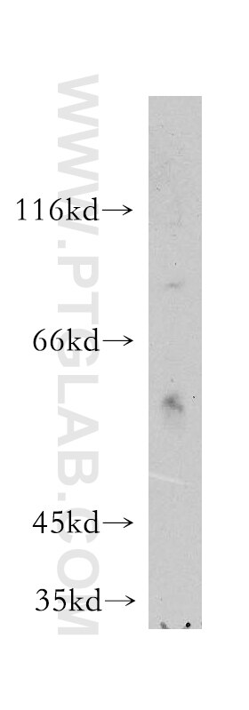 Western Blot (WB) analysis of HeLa cells using MAP4K5 Polyclonal antibody (12827-1-AP)