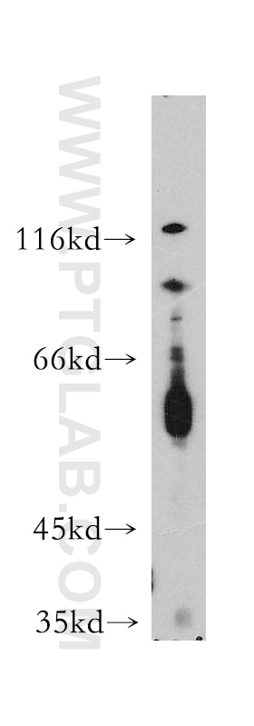 Western Blot (WB) analysis of K-562 cells using MAP4K5 Polyclonal antibody (12827-1-AP)