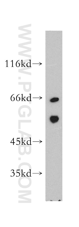 Western Blot (WB) analysis of RAW264.7 using MAP4K5 Polyclonal antibody (12827-1-AP)