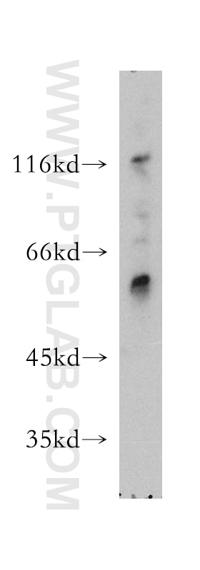 Western Blot (WB) analysis of mouse ovary tissue using MAP4K5 Polyclonal antibody (12827-1-AP)