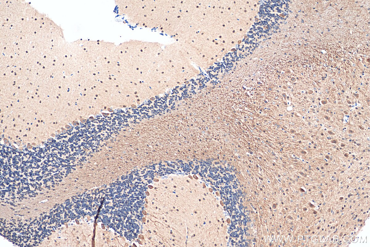 Immunohistochemistry (IHC) staining of mouse cerebellum tissue using MAP6/STOP Polyclonal antibody (25717-1-AP)