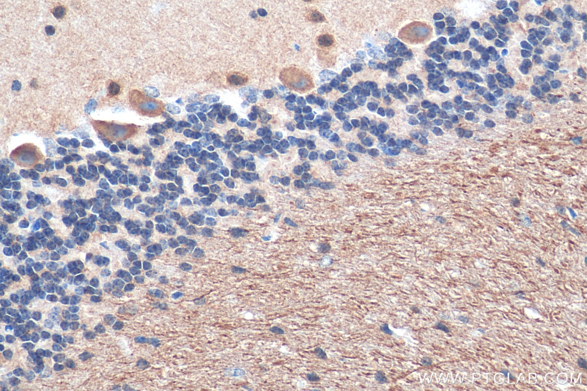 Immunohistochemistry (IHC) staining of mouse cerebellum tissue using MAP6/STOP Polyclonal antibody (25717-1-AP)