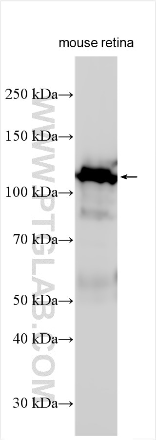 Western Blot (WB) analysis of various lysates using MAP6/STOP Polyclonal antibody (25717-1-AP)
