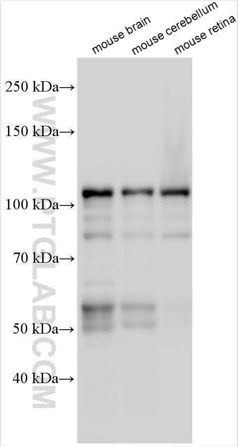 Western Blot (WB) analysis of various lysates using MAP6/STOP Polyclonal antibody (25717-1-AP)