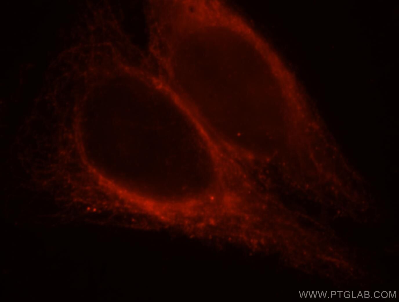 Immunofluorescence (IF) / fluorescent staining of HepG2 cells using MAP7 Polyclonal antibody (13446-1-AP)