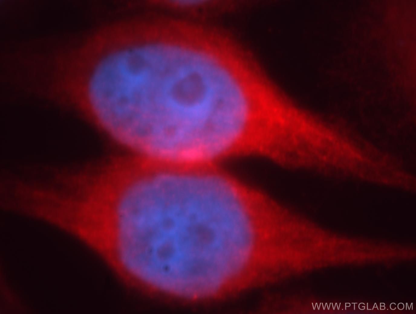 Immunofluorescence (IF) / fluorescent staining of HeLa cells using MAP7 Polyclonal antibody (13446-1-AP)