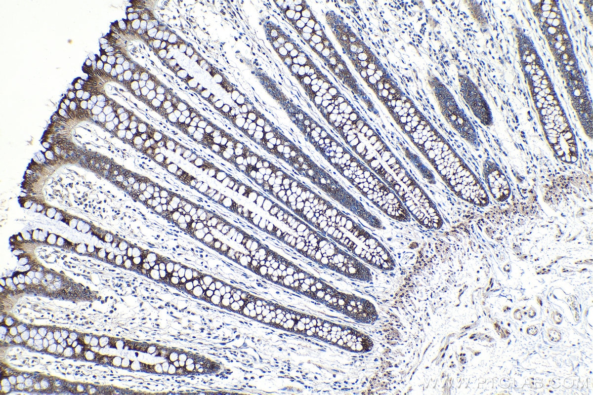 Immunohistochemistry (IHC) staining of human colon tissue using MAP7 Polyclonal antibody (13446-1-AP)