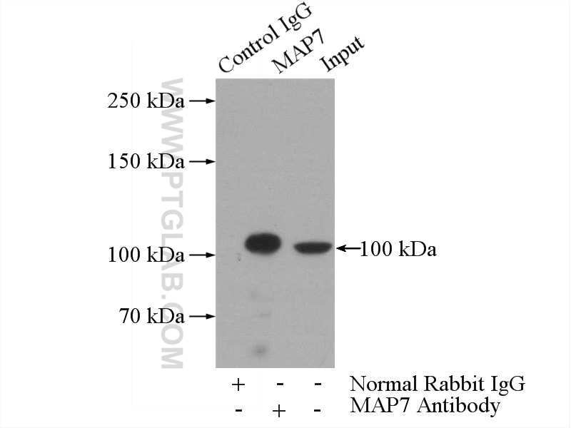 Immunoprecipitation (IP) experiment of HeLa cells using MAP7 Polyclonal antibody (13446-1-AP)