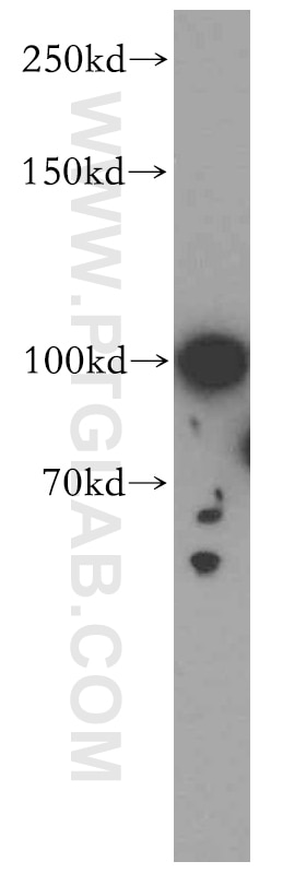 Western Blot (WB) analysis of HeLa cells using MAP7 Polyclonal antibody (13446-1-AP)