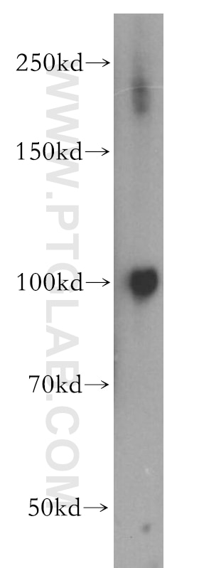 Western Blot (WB) analysis of A431 cells using MAP7 Polyclonal antibody (13446-1-AP)