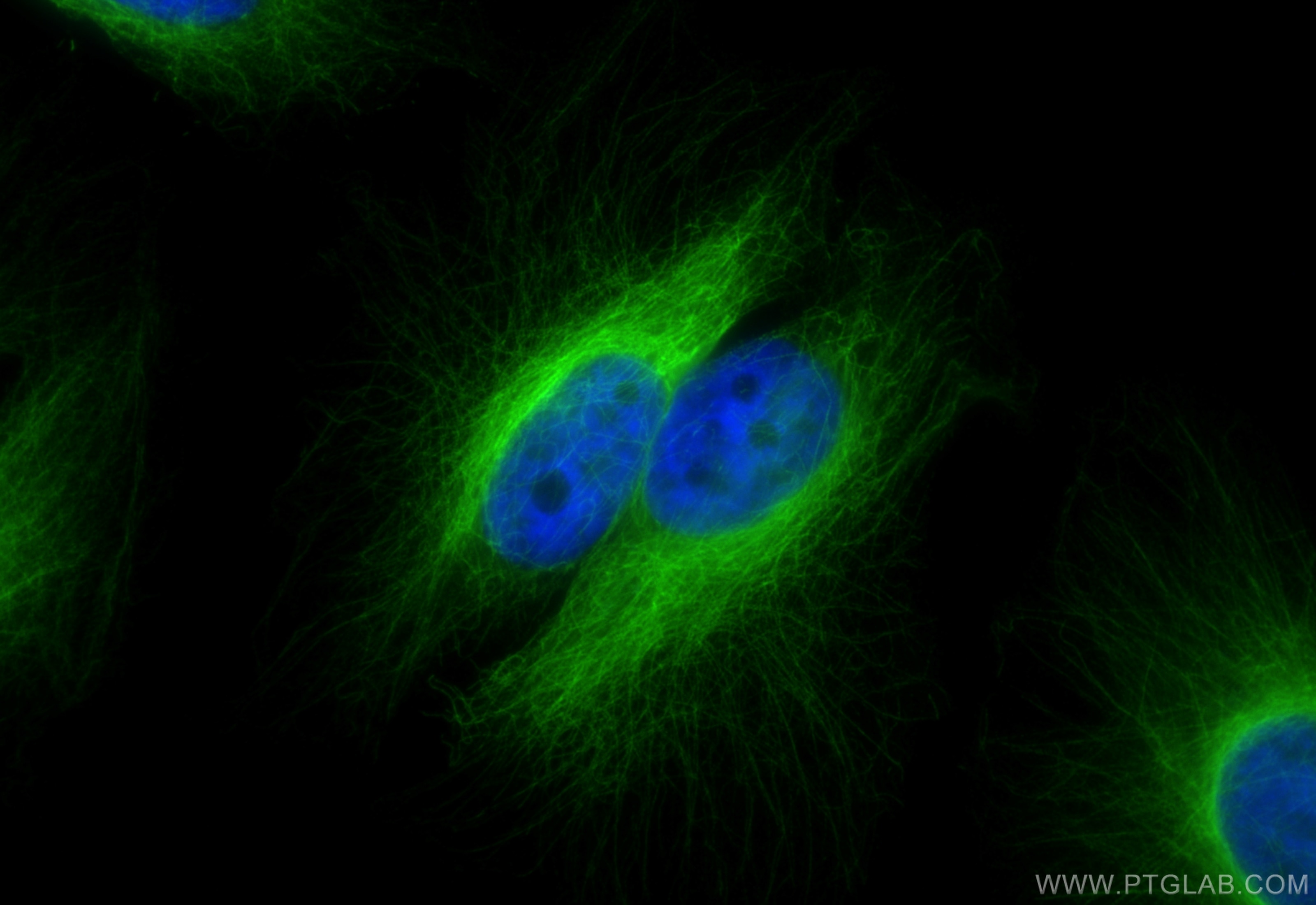 Immunofluorescent analysis of (4% PFA) fixed HeLa cells using MAP7D1 antibody (20788-1-AP) at dilution of 1:400 and CoraLite®488-Conjugated Goat Anti-Rabbit IgG(H+L) (SA00013-2). Immunofluorescence (IF) / fluorescent staining of HeLa cells using MAP7D1 Polyclonal antibody (20788-1-AP)