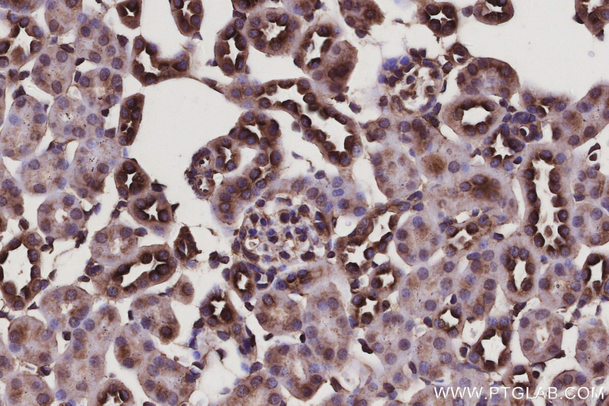 Immunohistochemistry (IHC) staining of mouse kidney tissue using MAP7D1 Polyclonal antibody (20788-1-AP)