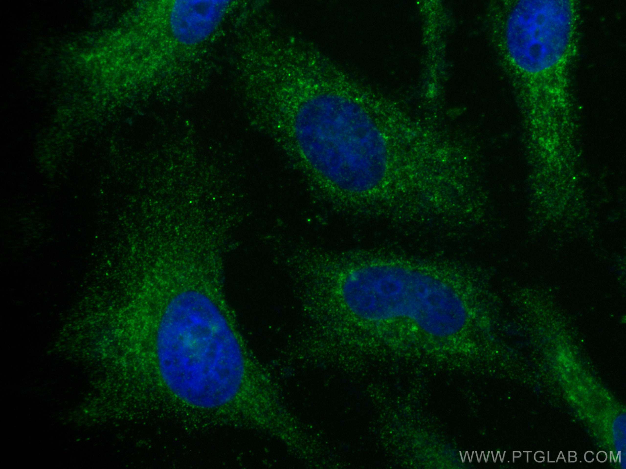 Immunofluorescence (IF) / fluorescent staining of HeLa cells using MAP9 Polyclonal antibody (26078-1-AP)