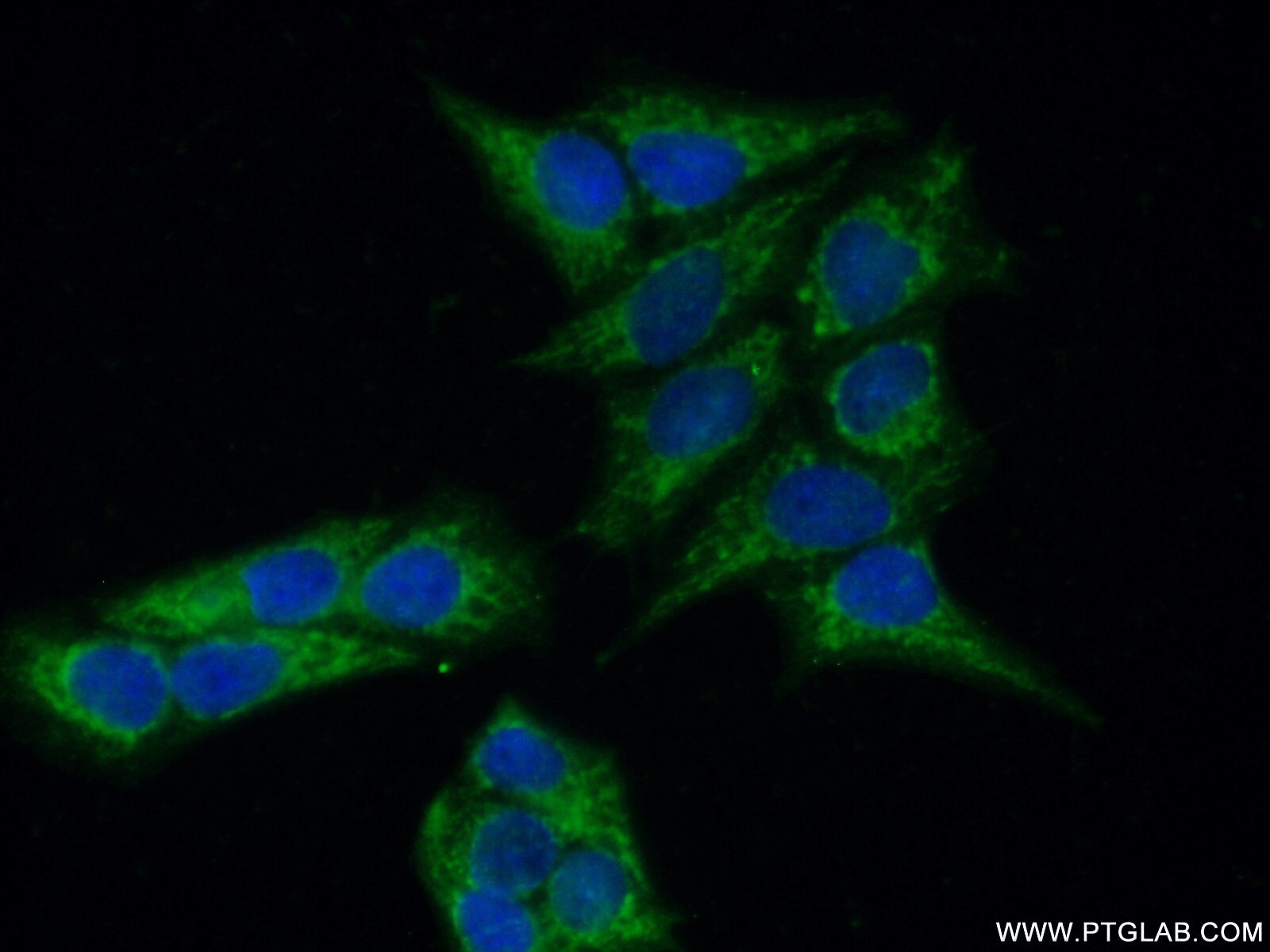 Immunofluorescence (IF) / fluorescent staining of HeLa cells using MAP9 Polyclonal antibody (26078-1-AP)