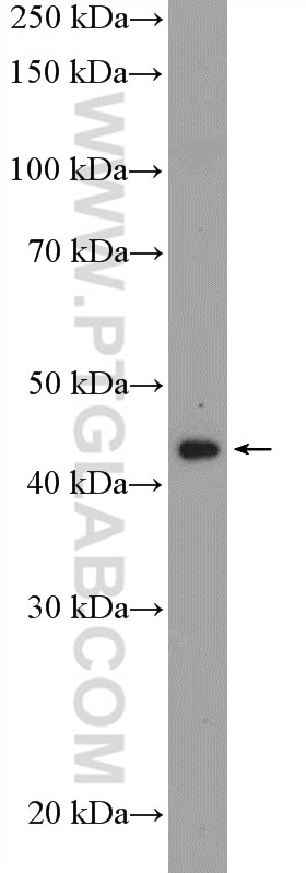 Western Blot (WB) analysis of SH-SY5Y cells using MAP9 Polyclonal antibody (26078-1-AP)