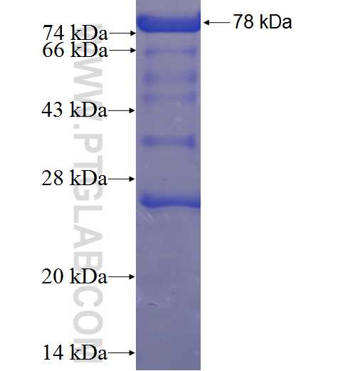 MAP9 fusion protein Ag23446 SDS-PAGE